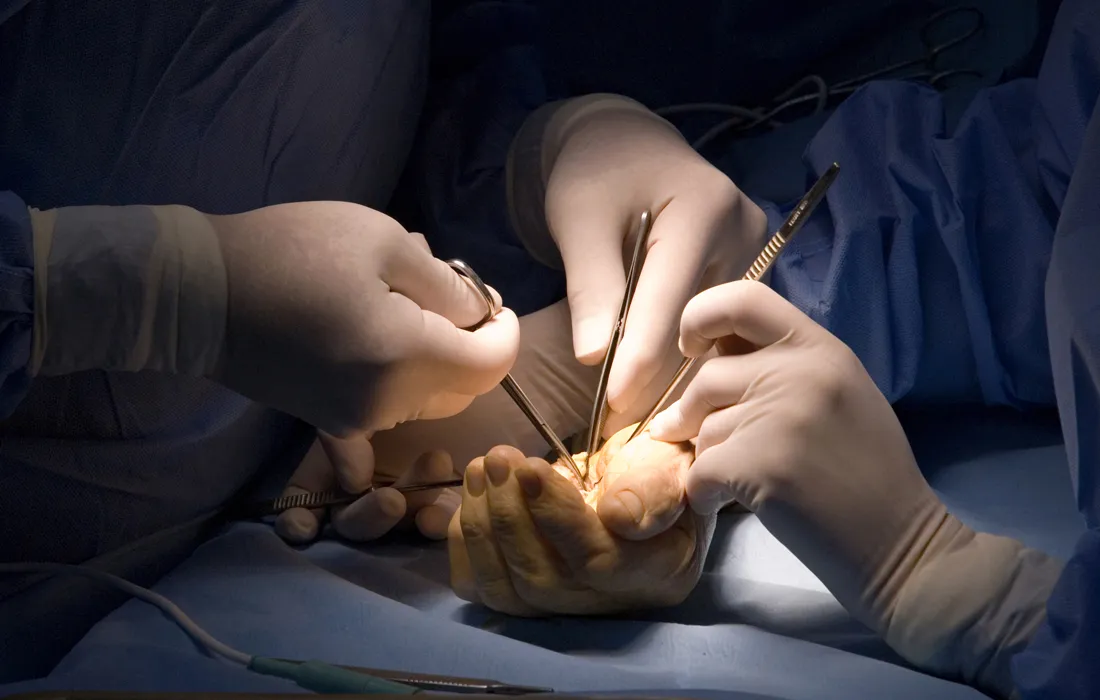 Especialización en Cirugía de Mano